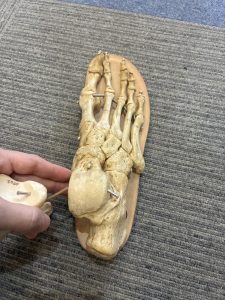 踵骨の外側偏位と足部骨格構造