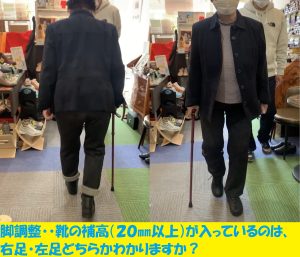 20mm以上の脚長差を靴底調整で補高した靴を履いて歩行しても見た目の違いが分かりにくい例