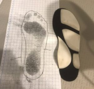 フットプリントと照合しながら製作したドイツ式固有受容器インソールの製作例